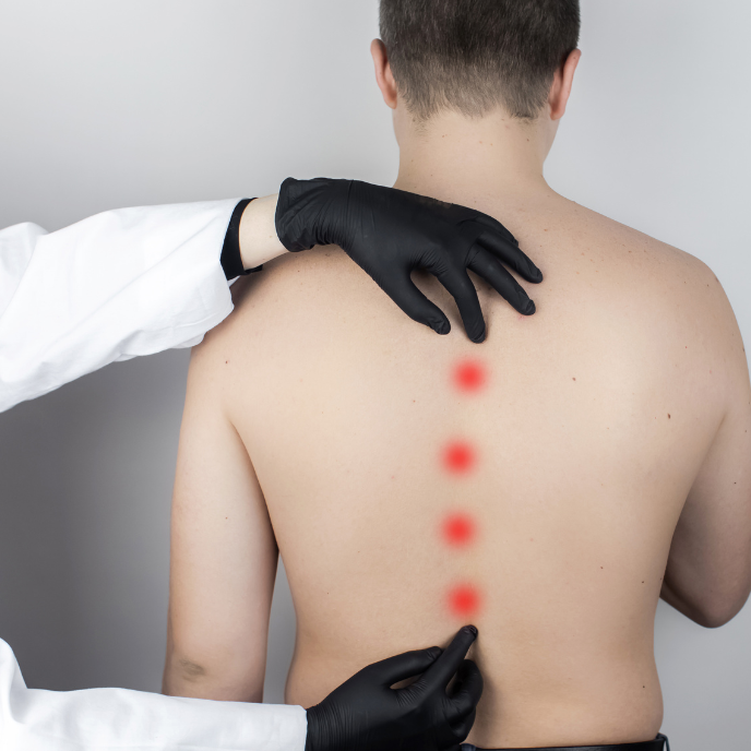 Scoliosis & Kyphosis Correction