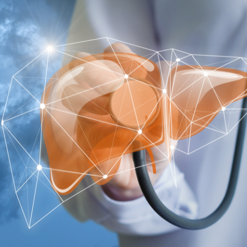 Liver Transplant