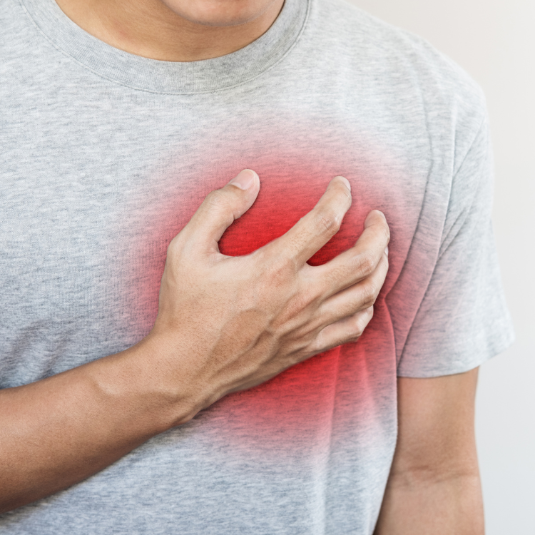 TAVI/TAVR